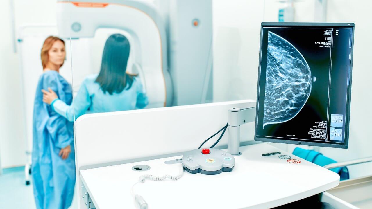 Mammography